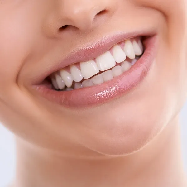 woman smiling - zoomed in on her teeth
